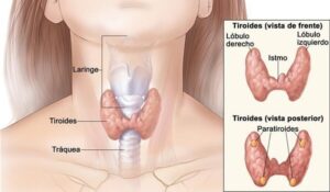 El hipotiroidismo es una enfermedad
